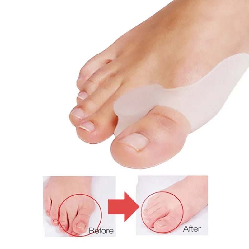 2 Orthèses en silicone pour hallux valgus
